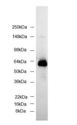 Detection of GFP Tagged Protein in Western Blot Using HRP Conjugated Antibody